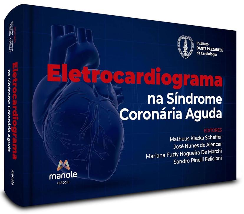 Eletrocardiograma na Síndrome Coronária Aguda - Capa do livro