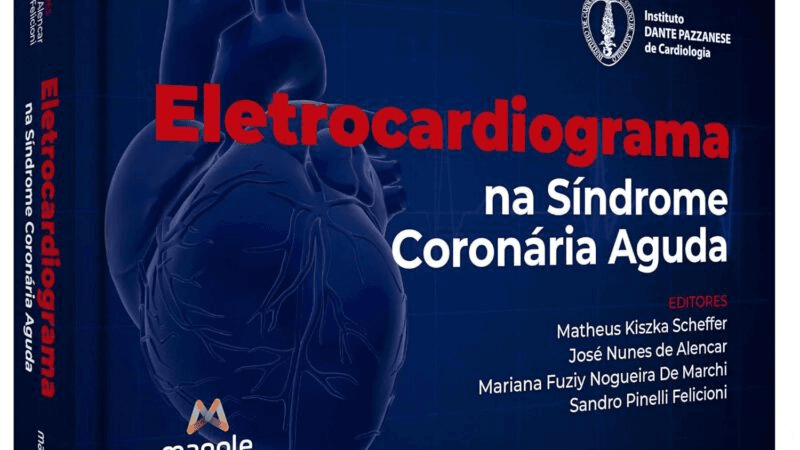 Bloqueios Interatriais: Conceito, Classificação e Implicações Clínicas