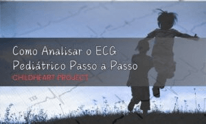 Fibrilação Atrial Pré-excitada