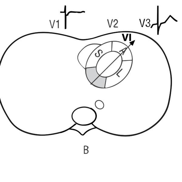 O Mito do Supra Feliz