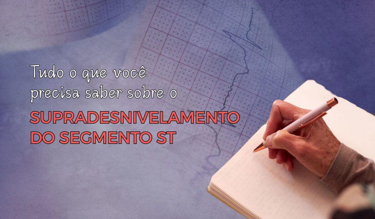 Algoritmo EPM para Localização de Vias Acessórias