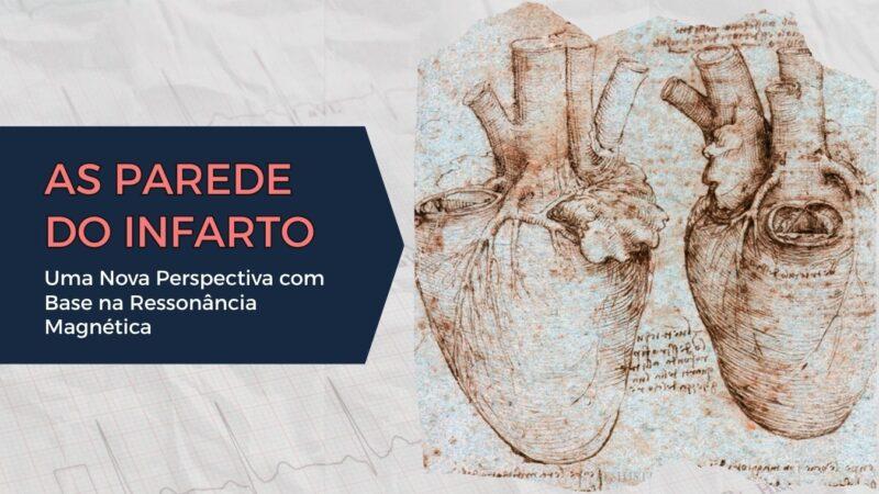 Paradoxo do Sem Falso Negativo No Diagnóstico do Infarto