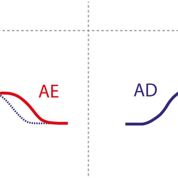 Progressão Lenta da Onda R
