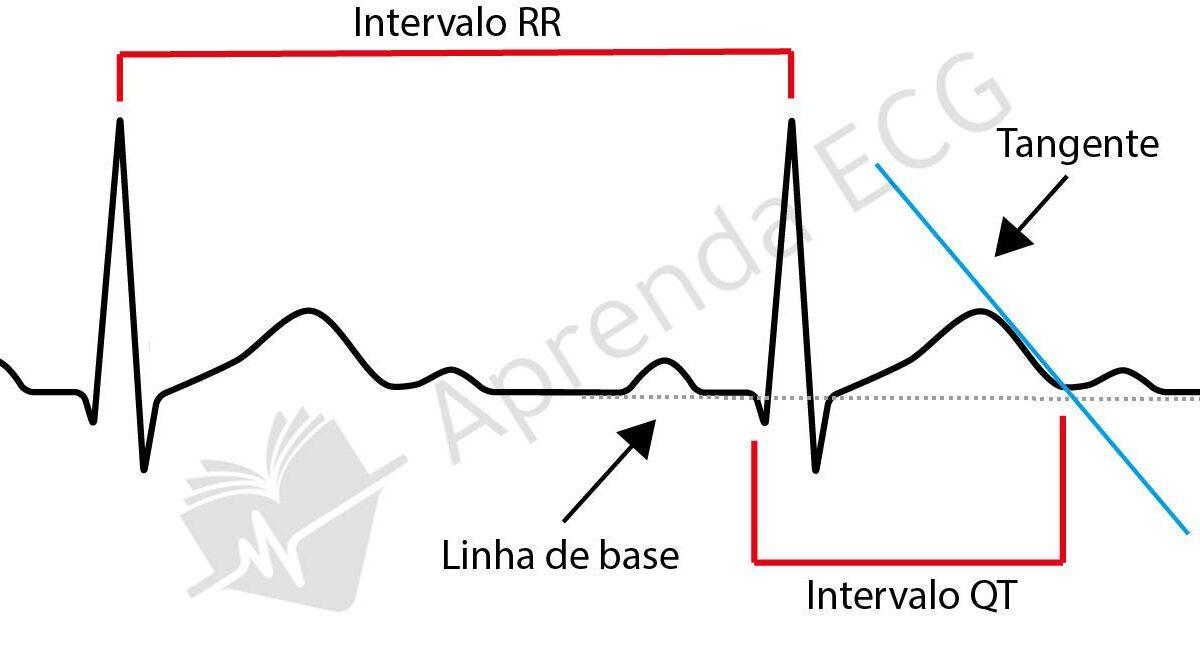 Calculadora: Intervalo QT Modificado