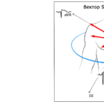 Tromboembolismo Pulmonar