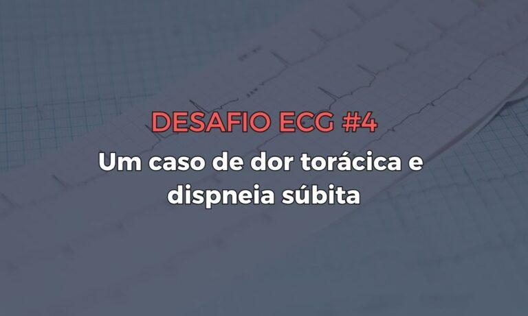 Identificando o Infarto da Parede Lateral: O Papel do ECG nas Oclusões da Circunflexa