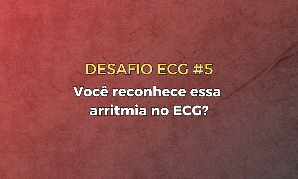 ECG Passo-a-Passo: Análise do Ritmo