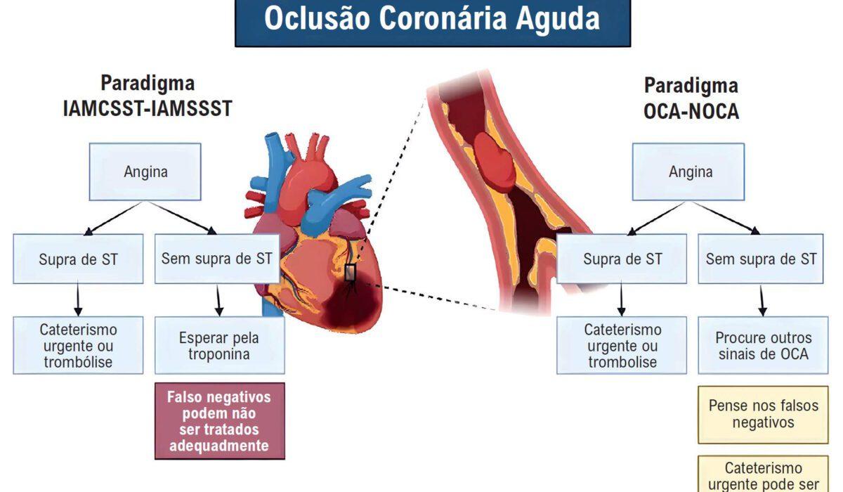 O ECG erra em pacientes com infarto de DA?