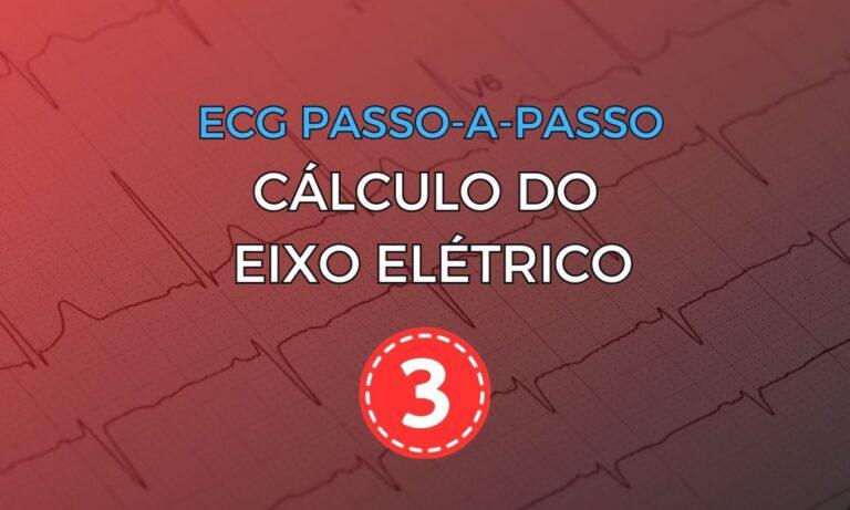 Como Analisar o ECG Pediátrico Passo a Passo (CHILDHEART Project)