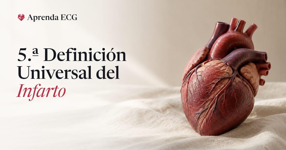 Elevación del ST en V2 sobre papel milimetrado, con las líneas de los umbrales de 1,5, 2 y 2,5 mm