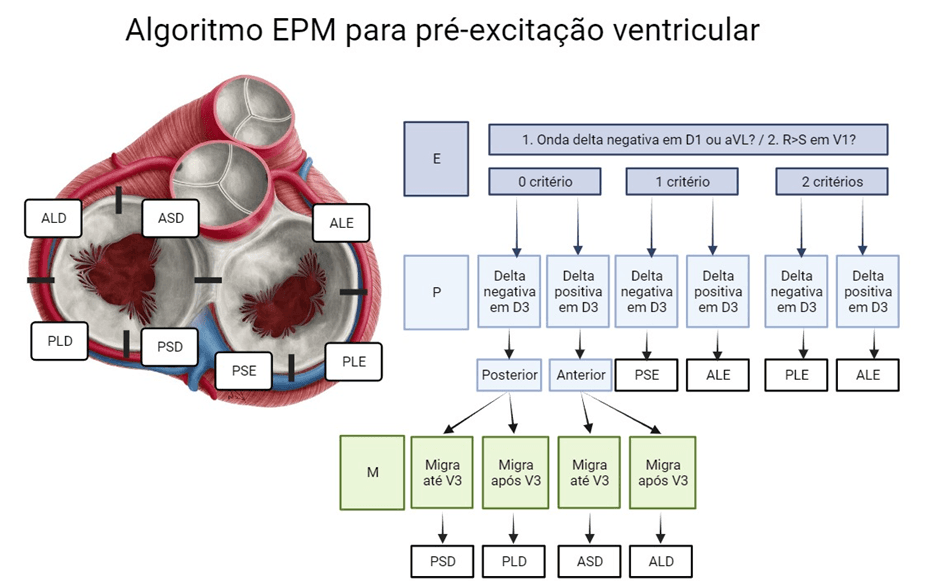 EPM algorithm used to localize accessory pathways on the electrocardiogram