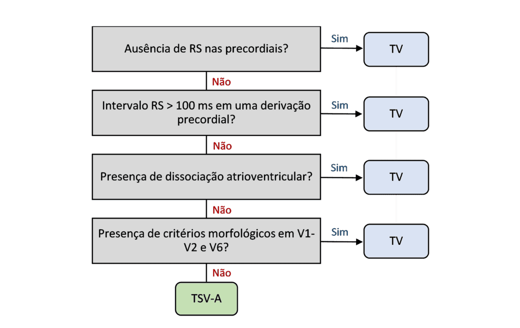 Brugada algorithm for the differential diagnosis between ventricular tachycardia and supraventricular tachycardia with aberrant conduction
