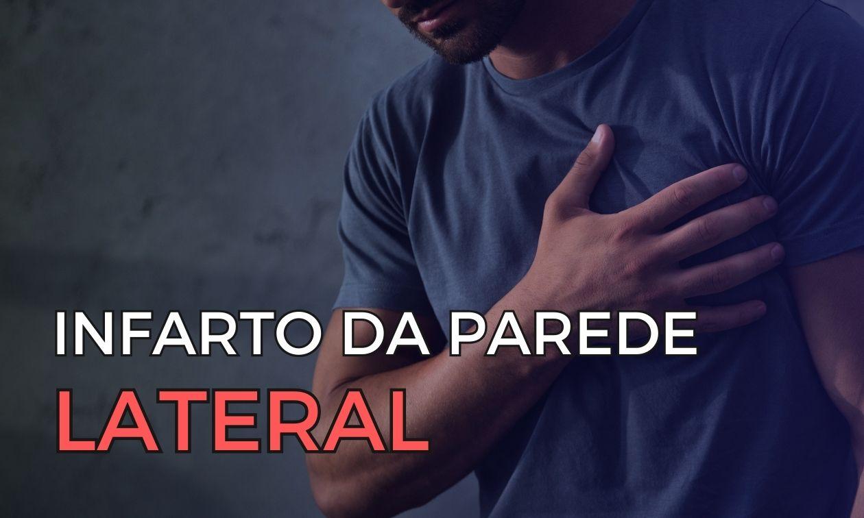 Identifying lateral wall infarction: the role of the ECG in circumflex artery occlusion