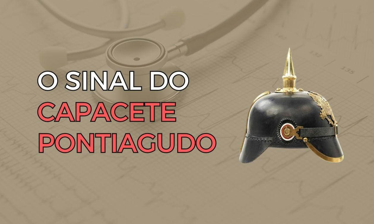 What does a Prussian spiked helmet have to do with the ECG?