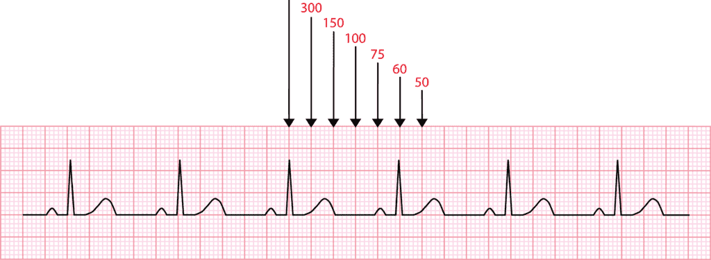Calculating HR on the ECG