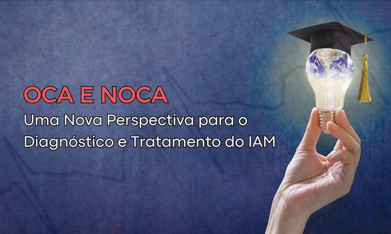 OCA y NOCA: Una Nueva Perspectiva para el Diagnóstico y Tratamiento del Infarto Agudo de Miocardio