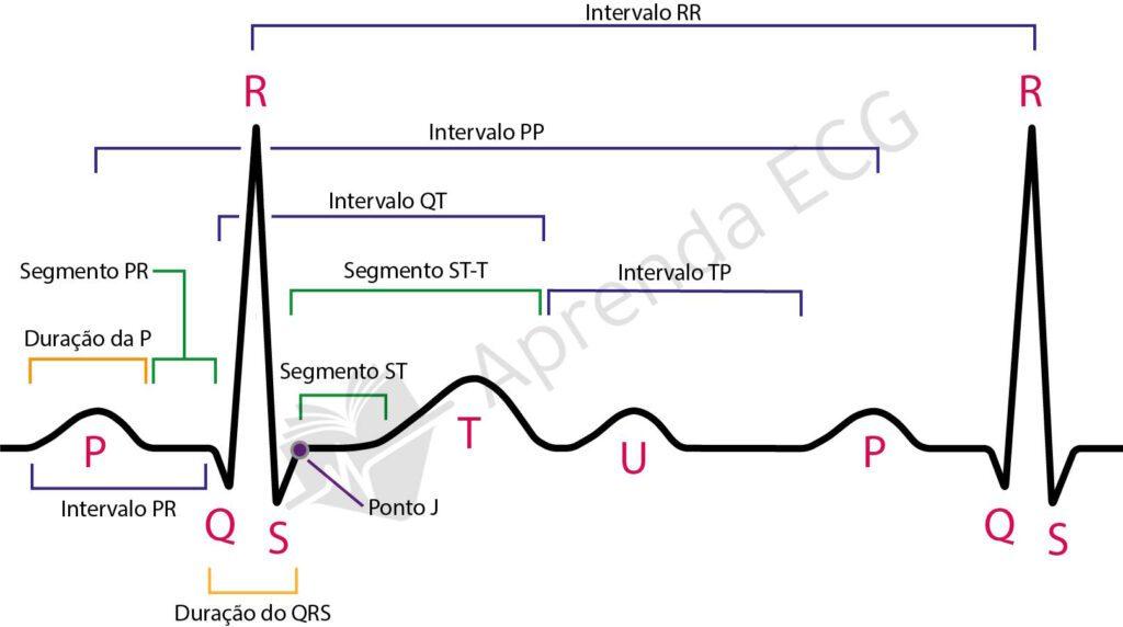 ECG waves and intervals