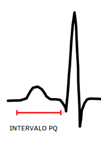 Schematic PQRST complex with the PR interval marked from the start of the P wave to the start of the QRS