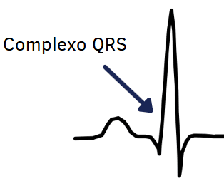 Schematic PQRST complex with an arrow pointing to the QRS complex