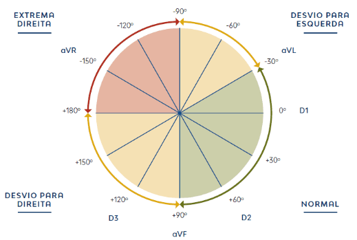 Frontal-plane hexaxial reference system showing normal axis, left, right and extreme axis deviation ranges