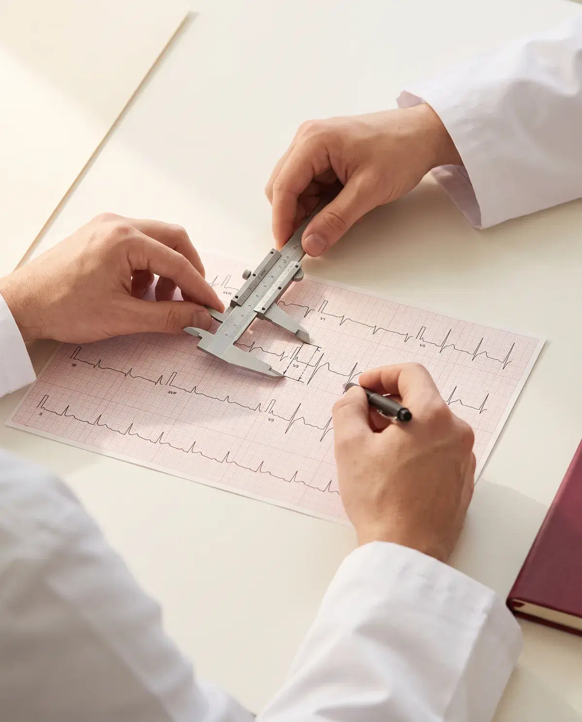 Médico medindo intervalos em um ECG impresso com compasso