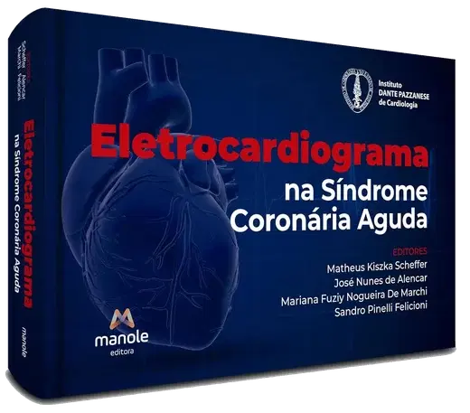 Capa: Eletrocardiograma na Síndrome Coronária Aguda