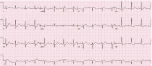 Retrospectiva Aprenda ECG 2024: Um Ano de Conquistas