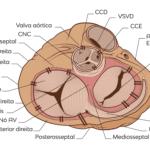 Afinal, O Que um Capacete Pontiagudo Prussiano Tem a Ver com o ECG?