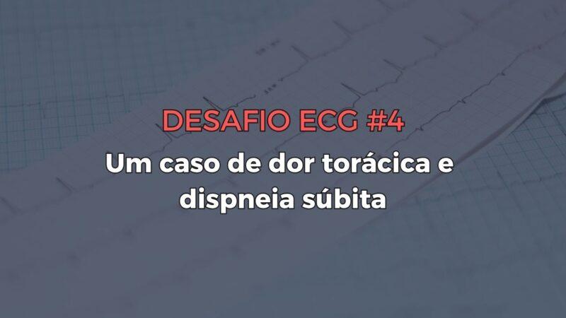 O Papel Crucial do ECG na Cardiomiopatia Hipertrófica