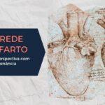 As Paredes do Infarto: Uma Nova Perspectiva com Base na Ressonância Magnética