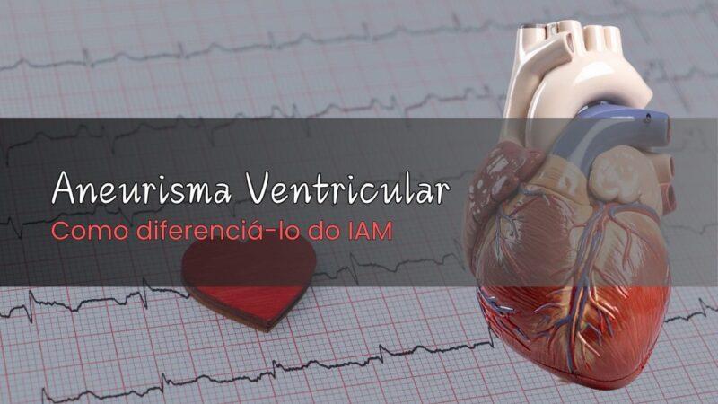 Tudo que Você Precisa Saber sobre o Supradesnivelamento do Segmento ST