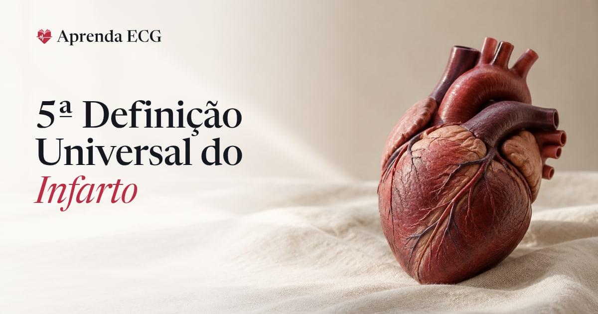 Supradesnivelamento do ST em V2 sobre papel milimetrado, com as linhas dos limiares de 1,5, 2 e 2,5 mm