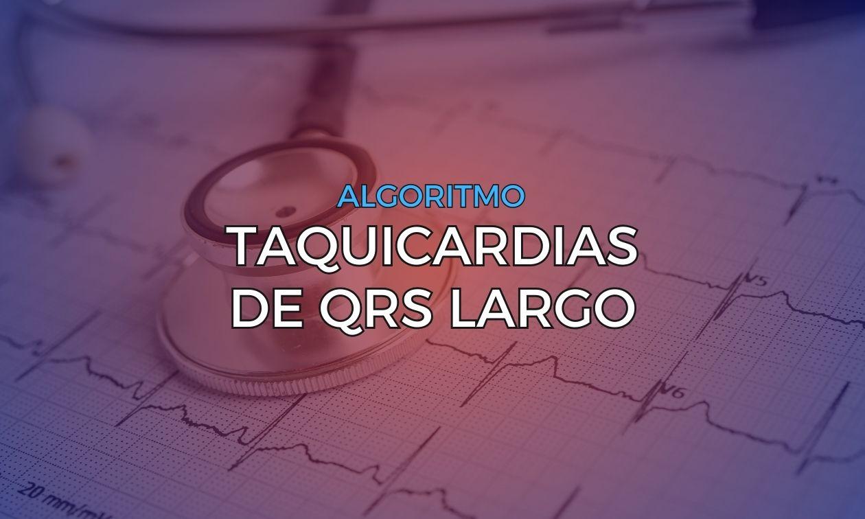 Algorithms for the differential diagnosis of wide QRS tachycardias