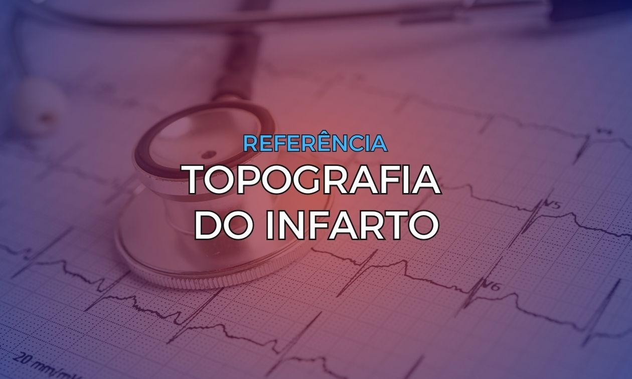 Infarct topography
