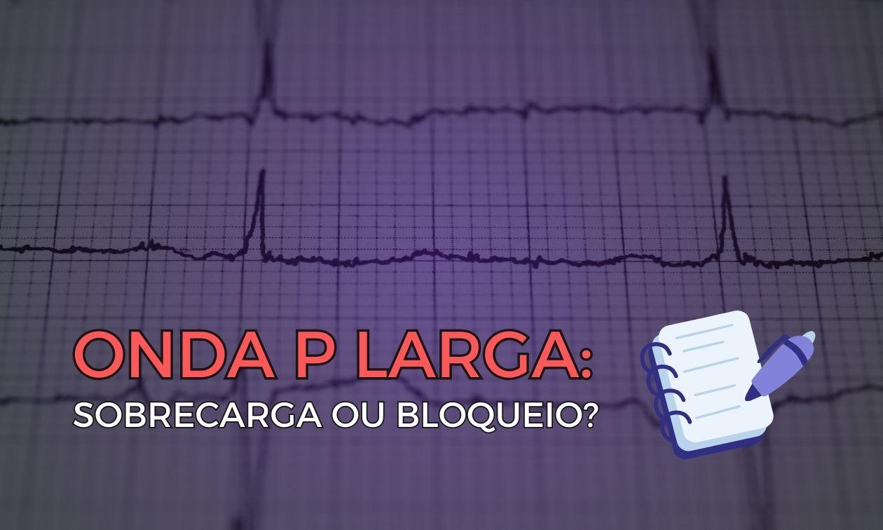 Wide P wave: atrial enlargement or block?