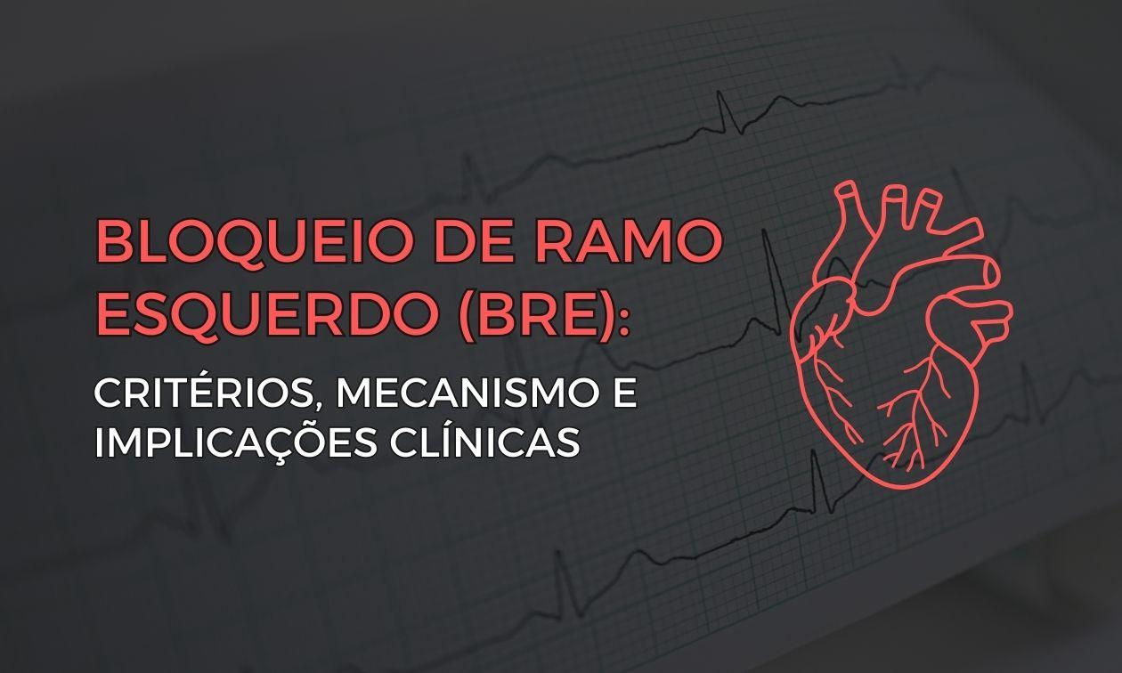 Left bundle branch block: criteria, mechanism and clinical implications
