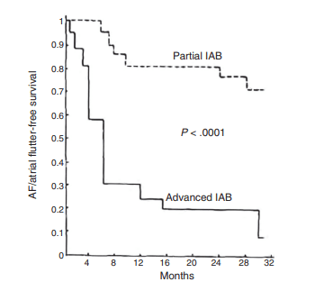 AF/flutter-free survival curves, much lower in advanced than in partial interatrial block (p < 0.0001)