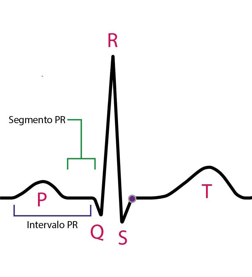 Representation of the PR interval and PR segment on the electrocardiogram
