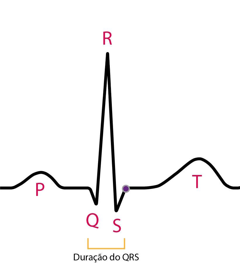 Representation of the QRS complex on the electrocardiogram