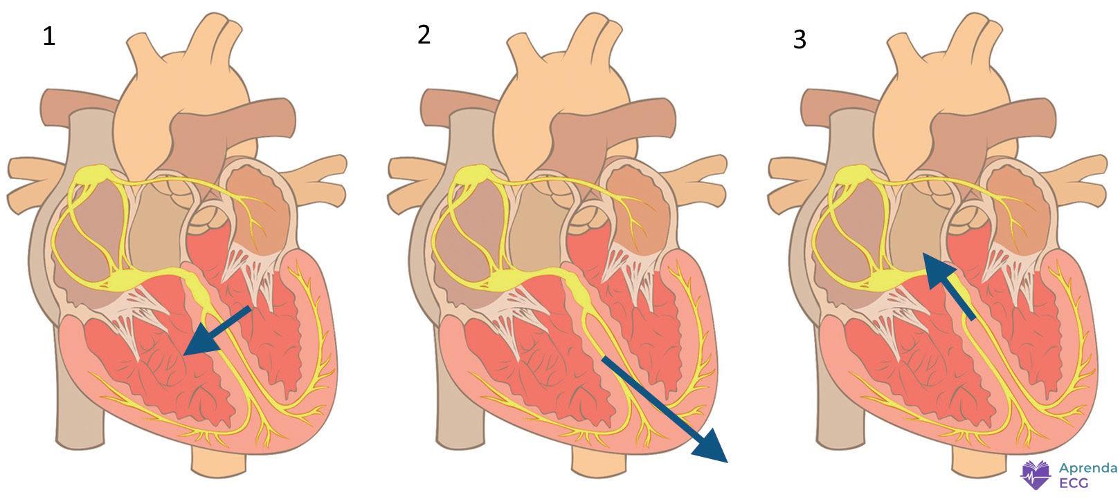 Diagram of ventricular activation showing the septal vector, the left ventricular free wall vector, and the basal vector