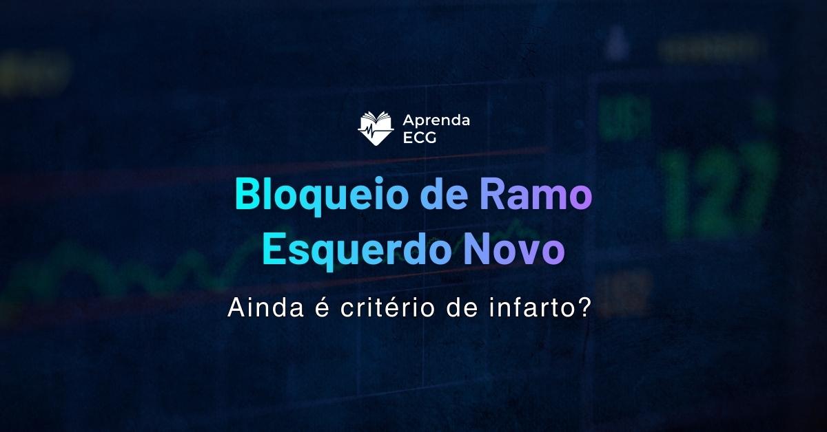 Bloqueio de ramo esquerdo novo: ainda é critério de infarto?