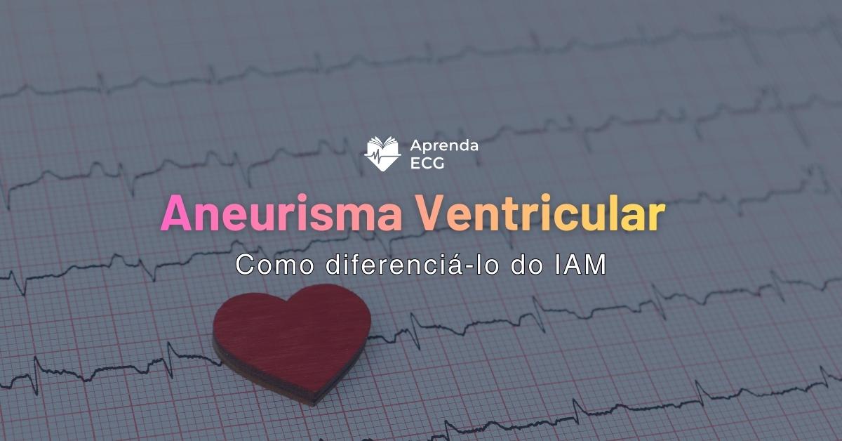 Como Diferenciar Aneurisma Ventricular do IAM