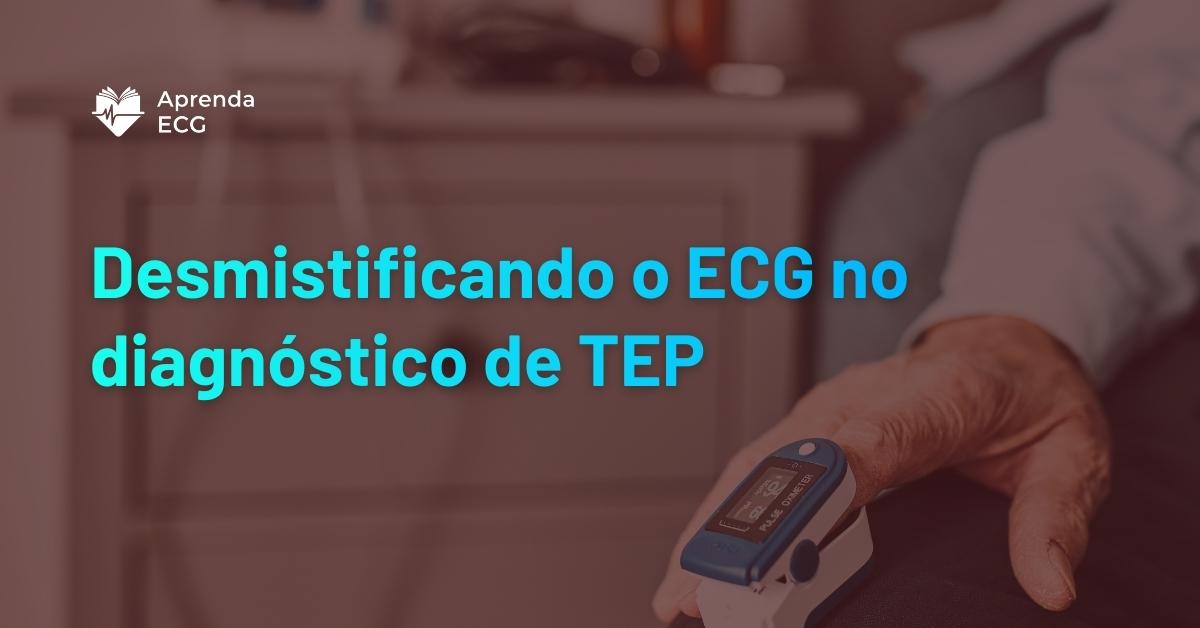 Desmistificando o ECG no diagnóstico de TEP