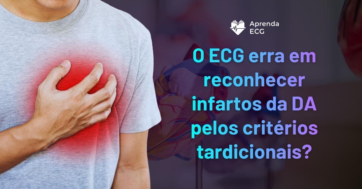 O ECG erra em pacientes com infarto de DA?