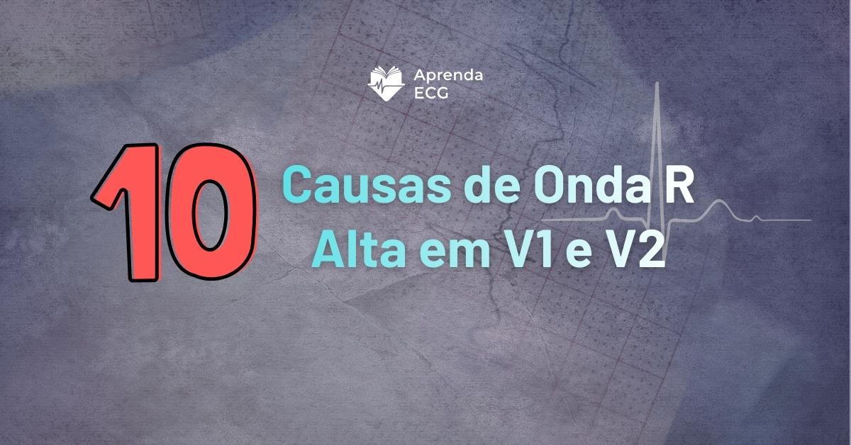 10 Causas de Onda R Alta em V1 e V2