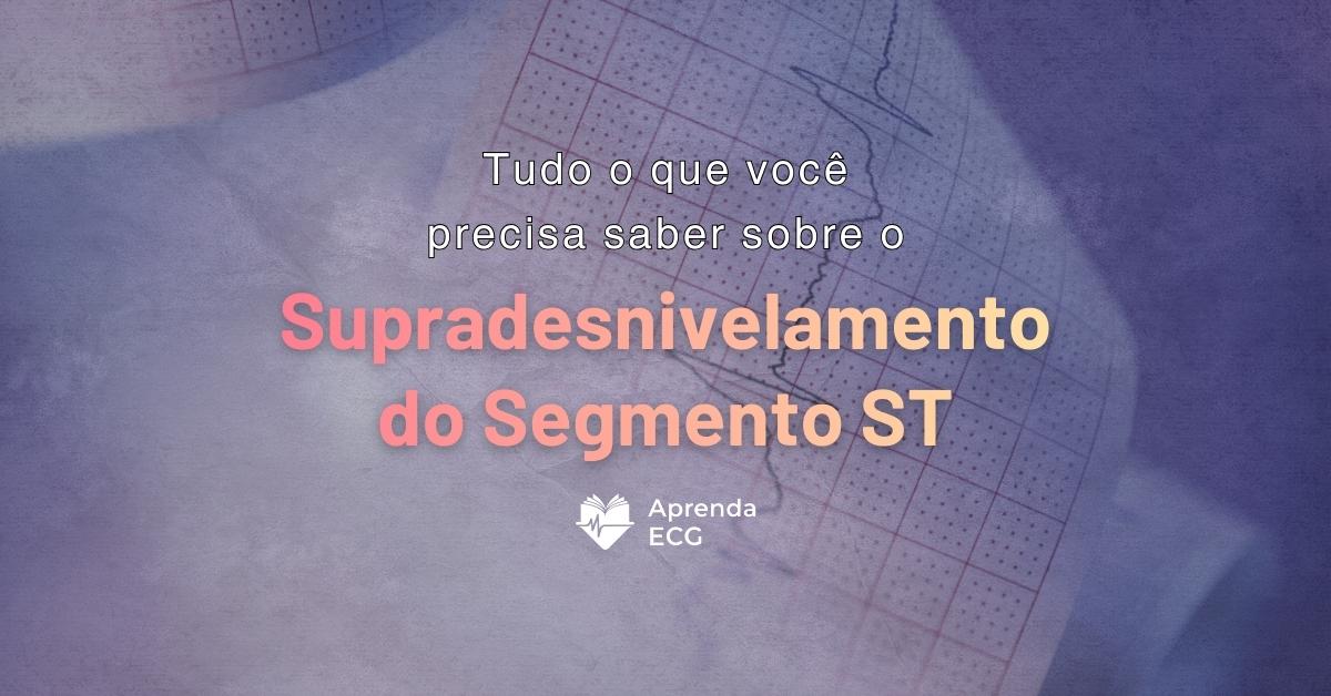 Tudo que Você Precisa Saber sobre o Supradesnivelamento do Segmento ST