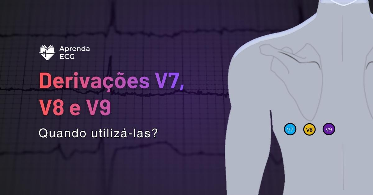 Derivações V7, V8 e V9: Quando utilizá-las?