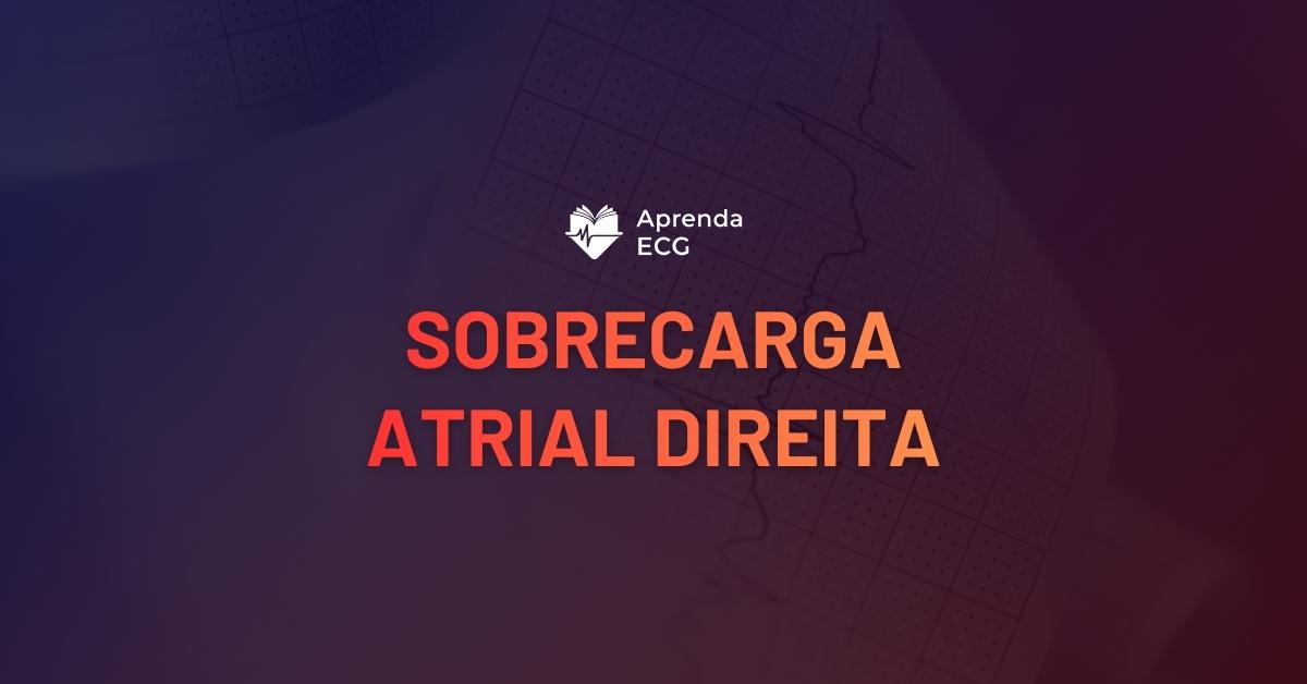 Sobrecarga Atrial Direita