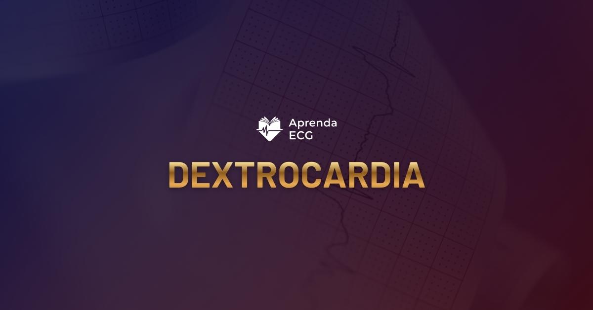 Dextrocardia