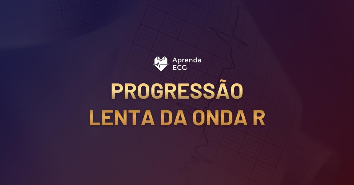 Progressão Lenta da Onda R